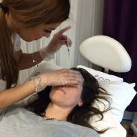 Drooping eyelids treatment non surgical