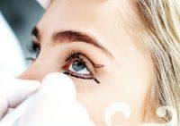 Blepharoplasty Is A Surgery To Remove Skin And To Add Or Remove Fat From The Eyelids