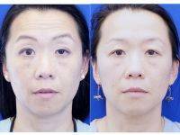 Plastic Surgery Operation For Correcting Defects, Deformities