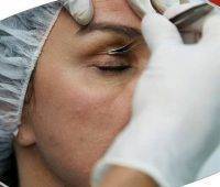 Eyelid Asymmetry In Patients Evaluated For Upper Lid Blepharoplasty